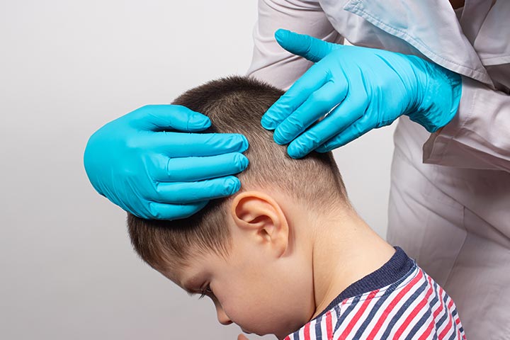 أسباب جفاف فروة الرأس وظهور قشرة الشعر عند الأطفال