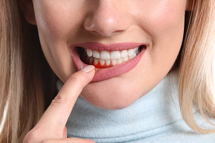 5 علامات خطرة في الأسنان.. لا تتجاهلها أبداً