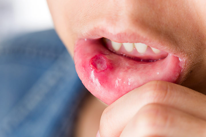 5 علامات خطرة في الأسنان.. لا تتجاهلها أبداً