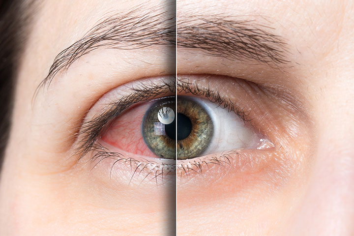 كيف نحافظ على صحة العيون خلال ساعات العمل؟