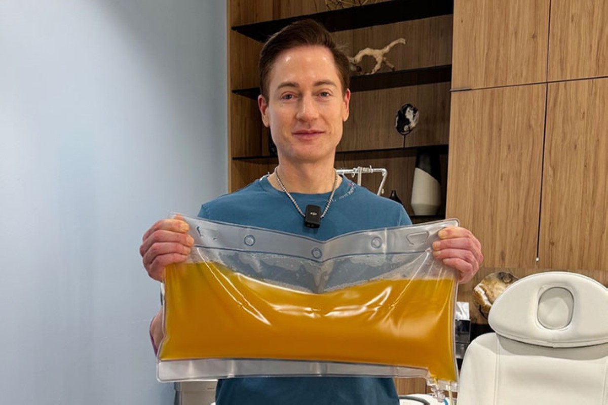 بريان جونسون يفتخر بنقل البلازما من دم ابنه إليه